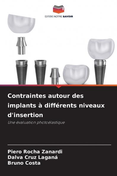 Contraintes autour des implants à différents niveaux d'insertion