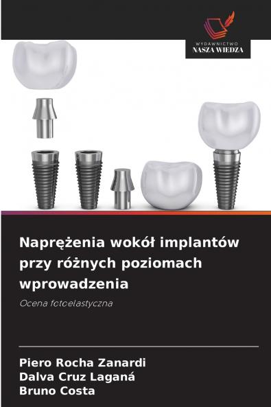 Naprężenia wokół implantów przy różnych poziomach wprowadzenia