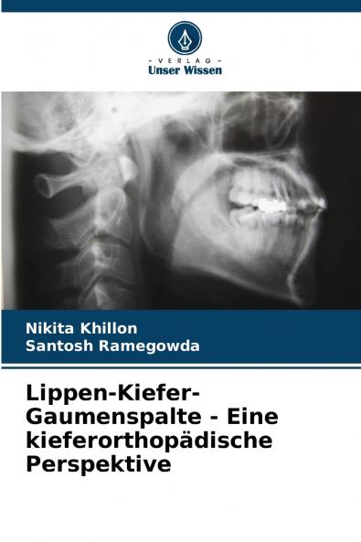 Lippen-Kiefer-Gaumenspalte - Eine kieferorthopädische Perspektive