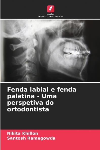 Fenda labial e fenda palatina - Uma perspetiva do ortodontista