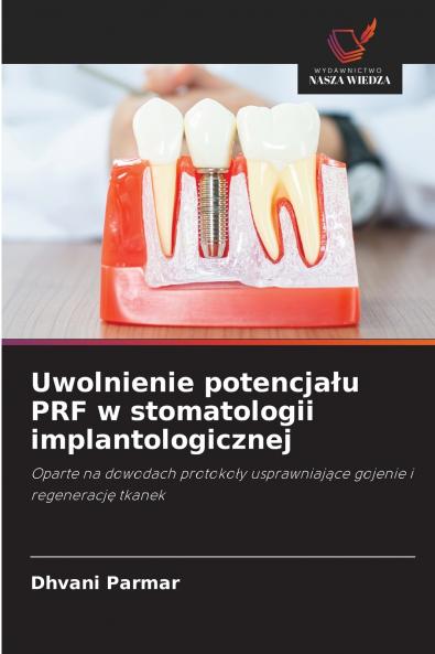 Uwolnienie potencjału PRF w stomatologii implantologicznej