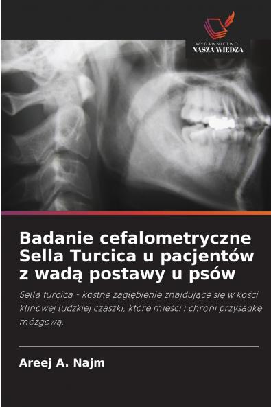 Badanie cefalometryczne Sella Turcica u pacjentów z wadą postawy u psów