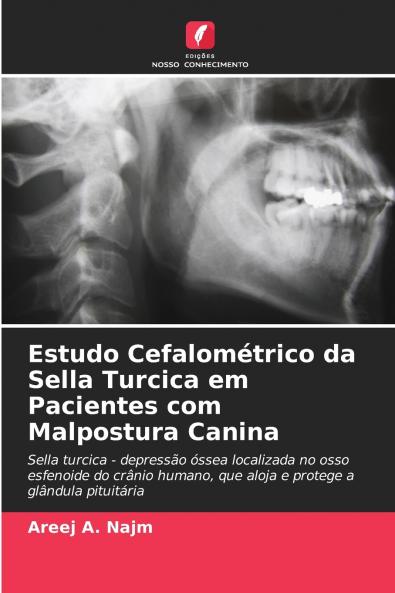 Estudo Cefalométrico da Sella Turcica em Pacientes com Malpostura Canina