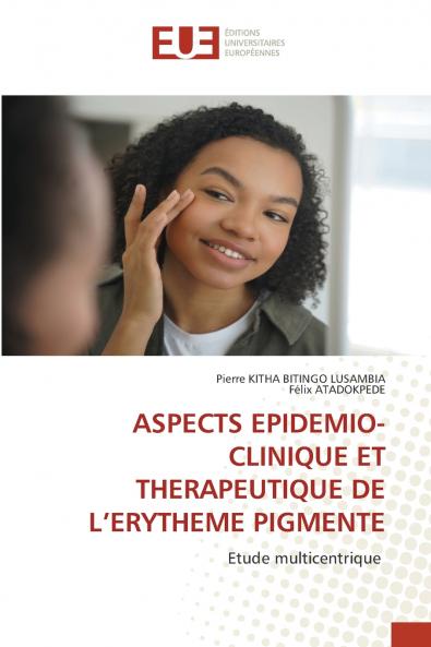 ASPECTS EPIDEMIO-CLINIQUE ET THERAPEUTIQUE DE L'ERYTHEME PIGMENTE
