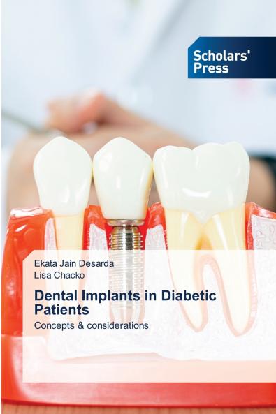 Dental Implants in Diabetic Patients