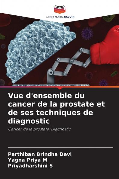 Vue d'ensemble du cancer de la prostate et de ses techniques de diagnostic