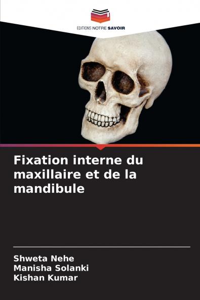 Fixation interne du maxillaire et de la mandibule