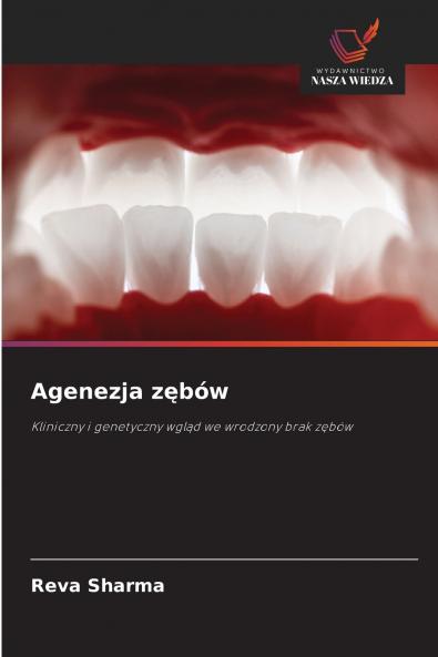 Agenezja zębów