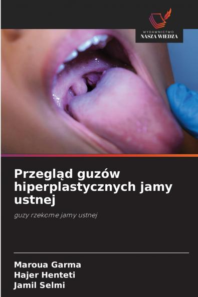 Przegląd guzów hiperplastycznych jamy ustnej