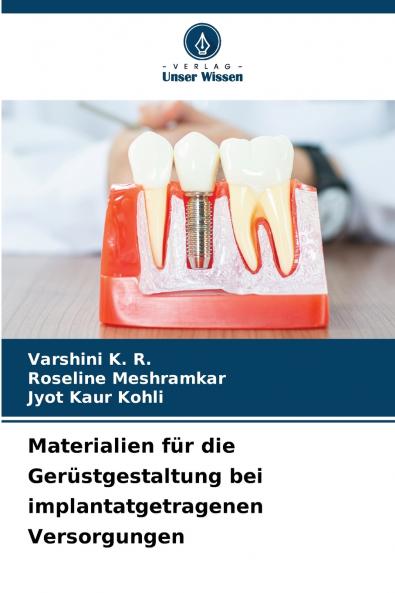 Materialien für die Gerüstgestaltung bei implantatgetragenen Versorgungen