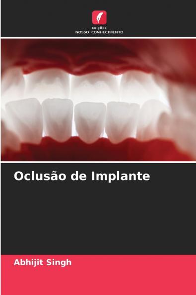 Oclusão de Implante