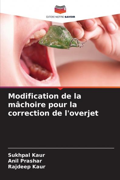 Modification de la mâchoire pour la correction de l'overjet