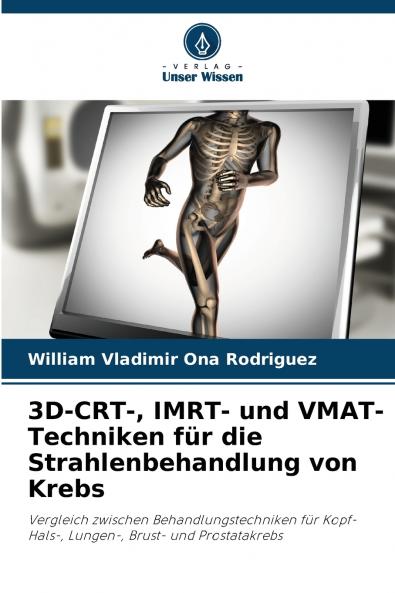 3D-CRT- IMRT- und VMAT-Techniken für die Strahlenbehandlung von Krebs
