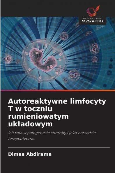 Autoreaktywne limfocyty T w toczniu rumieniowatym układowym