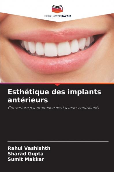 Esthétique des implants antérieurs