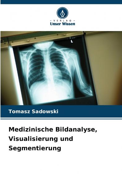 Medizinische Bildanalyse Visualisierung und Segmentierung