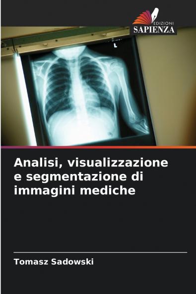 Analisi visualizzazione e segmentazione di immagini mediche