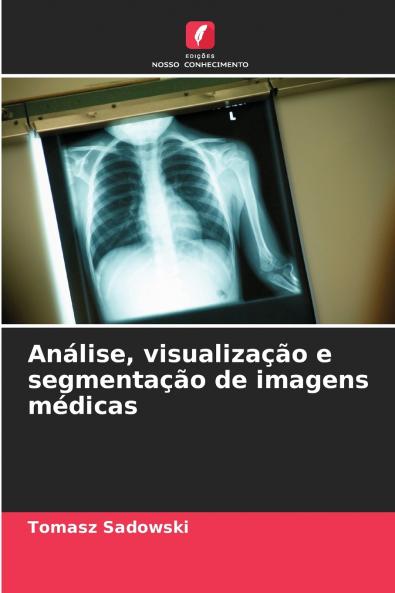 Análise visualização e segmentação de imagens médicas