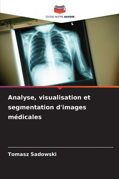 Analyse visualisation et segmentation d'images médicales