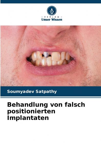 Behandlung von falsch positionierten Implantaten