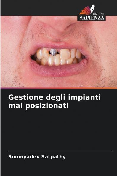 Gestione degli impianti mal posizionati