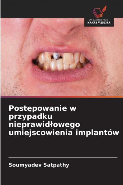 Postępowanie w przypadku nieprawidłowego umiejscowienia implantów