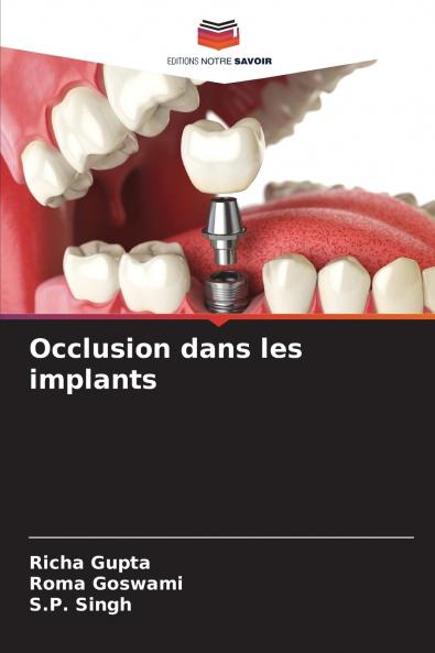 Occlusion dans les implants