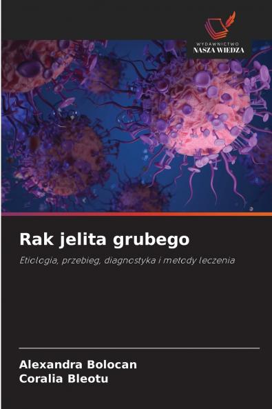 Rak jelita grubego