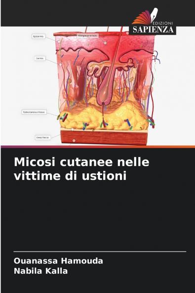 Micosi cutanee nelle vittime di ustioni