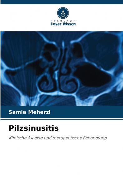 Pilzsinusitis