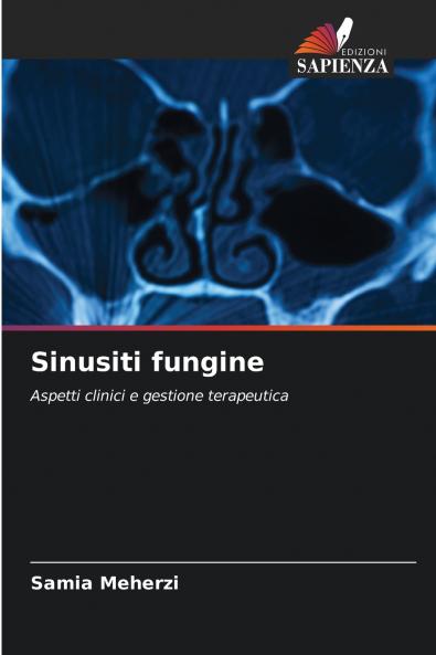 Sinusiti fungine