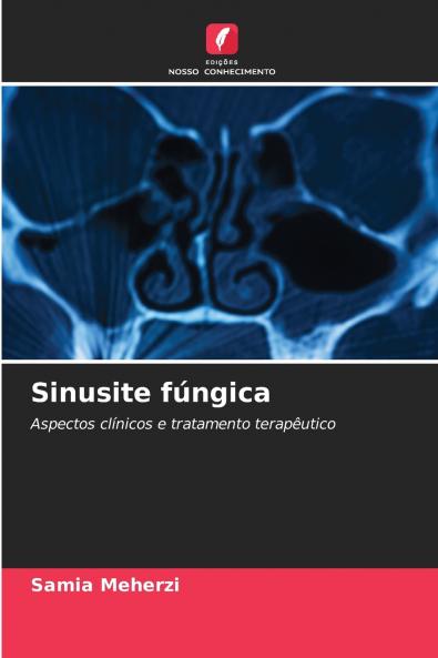 Sinusite fúngica