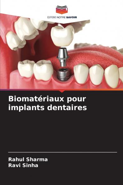 Biomatériaux pour implants dentaires