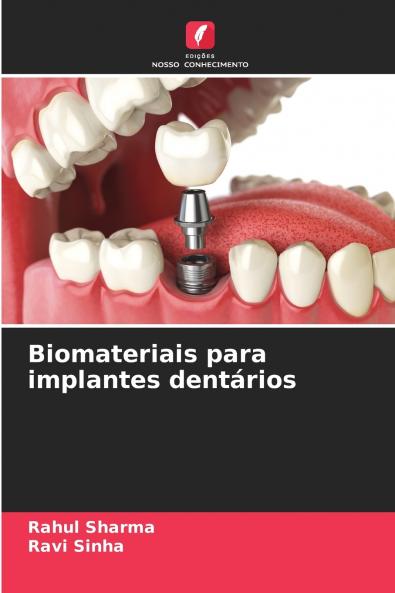 Biomateriais para implantes dentários