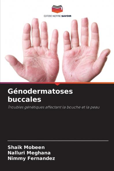 Génodermatoses buccales