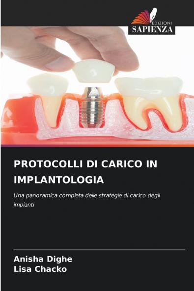 PROTOCOLLI DI CARICO IN IMPLANTOLOGIA