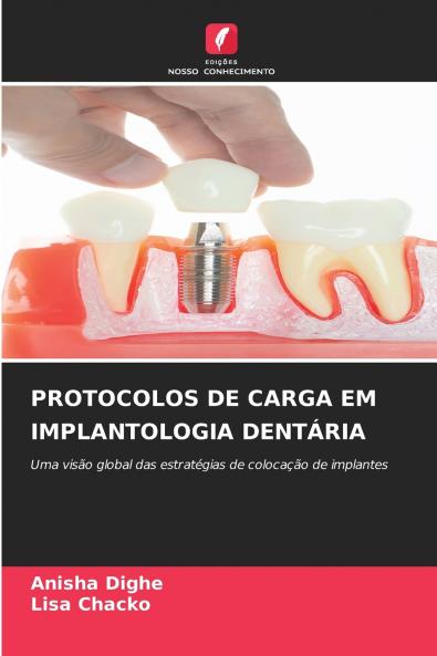 PROTOCOLOS DE CARGA EM IMPLANTOLOGIA DENTÁRIA