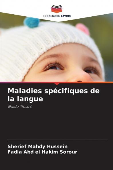 Maladies spécifiques de la langue