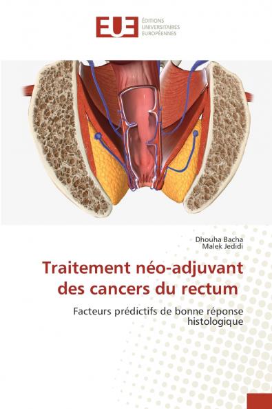 Traitement néo-adjuvant des cancers du rectum