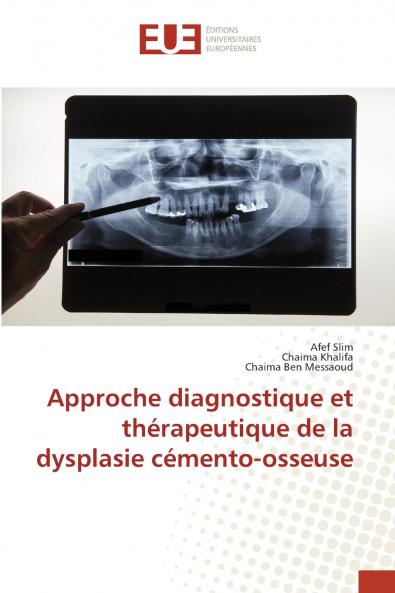 Approche diagnostique et thérapeutique de la dysplasie cémento-osseuse
