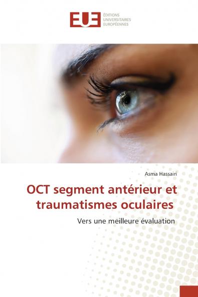 OCT segment antérieur et traumatismes oculaires