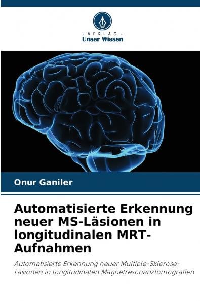 Automatisierte Erkennung neuer MS-Läsionen in longitudinalen MRT-Aufnahmen