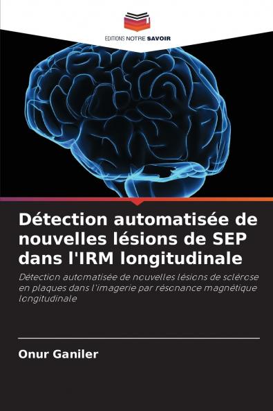 Détection automatisée de nouvelles lésions de SEP dans l'IRM longitudinale