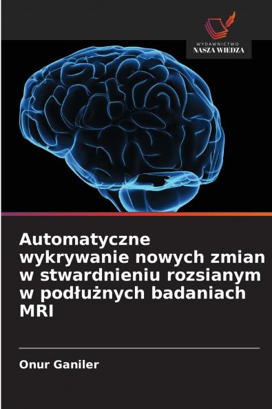 Automatyczne wykrywanie nowych zmian w stwardnieniu rozsianym w podłużnych badaniach MRI