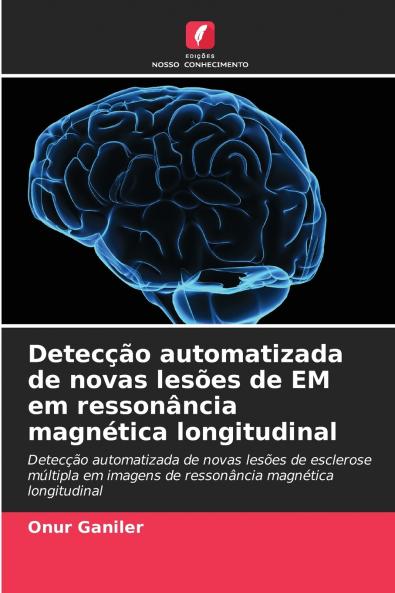 Detecção automatizada de novas lesões de EM em ressonância magnética longitudinal