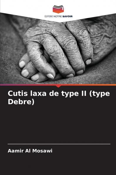 Cutis laxa de type II (type Debre)