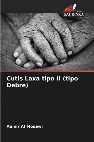 Cutis Laxa tipo II (tipo Debre)
