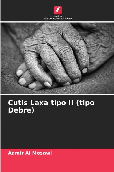 Cutis Laxa tipo II (tipo Debre)