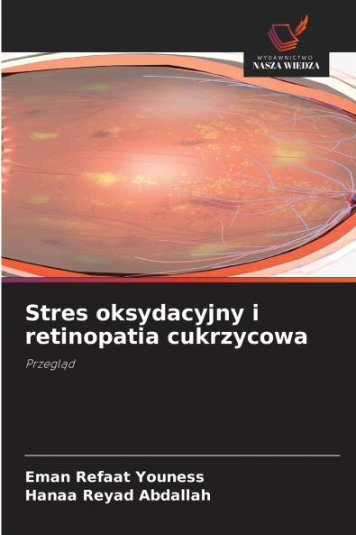 Stres oksydacyjny i retinopatia cukrzycowa