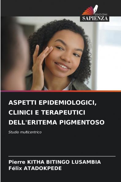 ASPETTI EPIDEMIOLOGICI CLINICI E TERAPEUTICI DELL'ERITEMA PIGMENTOSO